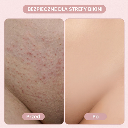 Glowora Lumi™ 2 w 1 golarka do ciała dla kobiet