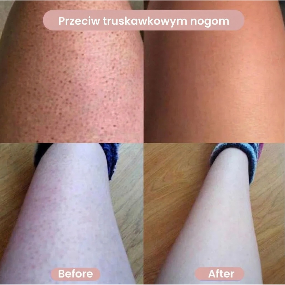 Glowora Lumi™ 2 w 1 golarka do ciała dla kobiet